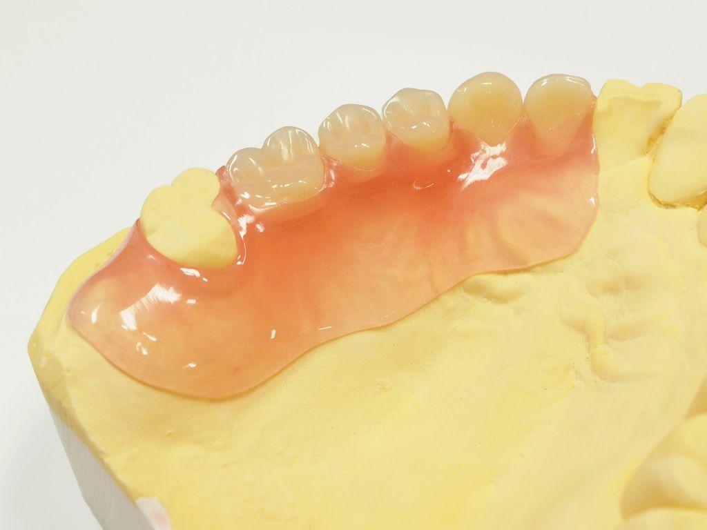 入れ歯を作る過程の模型