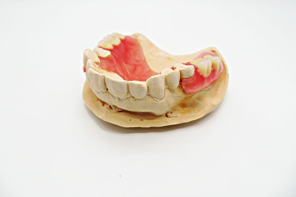入れ歯の模型