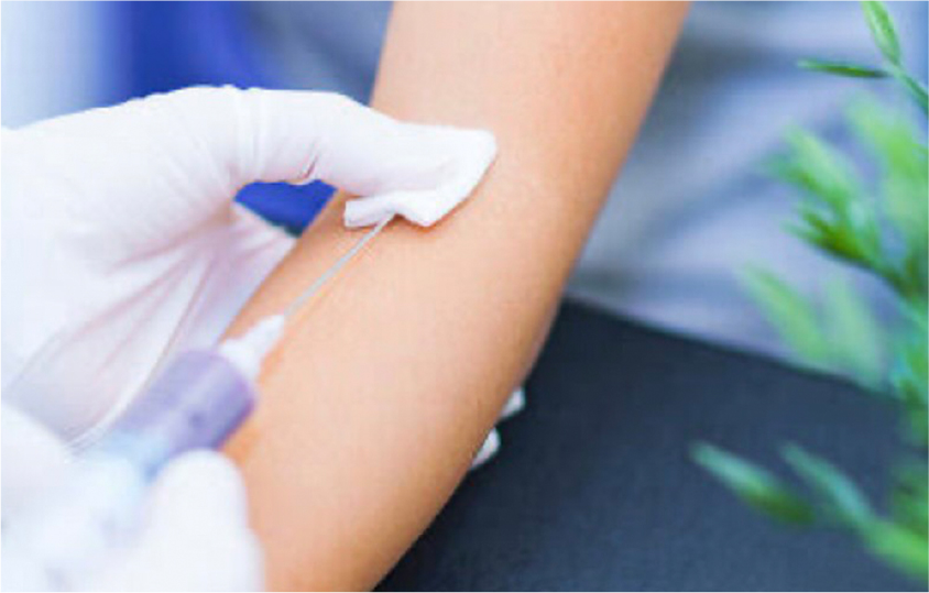 血液検査の写真